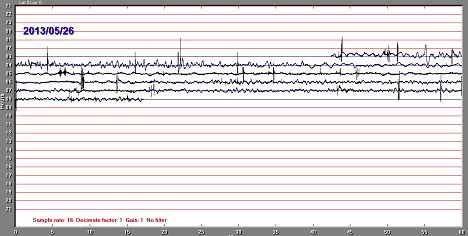 Hourly graph of infrasound and minor shockwaves using the INFILTEC INFRA20 infrasound sensor